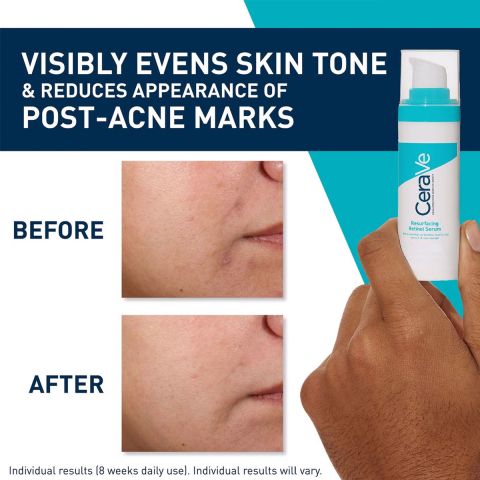 CeraVe - Retinol Serum Anti-Infections - 30 ml