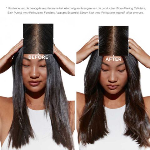Kérastase - Symbiose Fondant Apaisant Essentiel Anti-Dandruff Conditioner - 200 ml