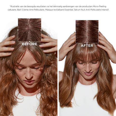 Kérastase - Symbiose Micro-Peeling Cellular Anti-Dandruff Treatment - 200 ml