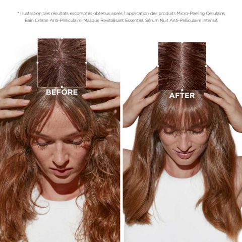 Kérastase - Symbiose Masque Revitalisant Essentiel Anti-Dandruff Mask - 200 ml