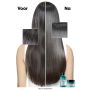 L'Oréal Professionnel - Scalp Advanced Anti Oiliness - Shampoo oily scalp
